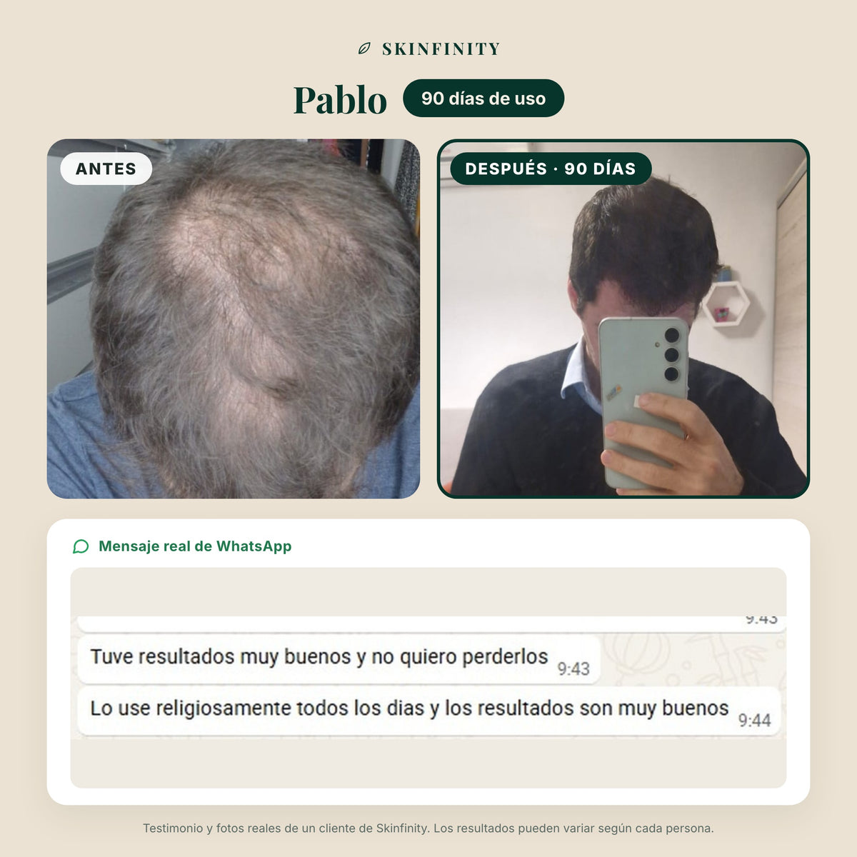 Serum Skinfinity - Fórmula avanzada de Saw Palmetto y Jojoba para crecimiento capilar