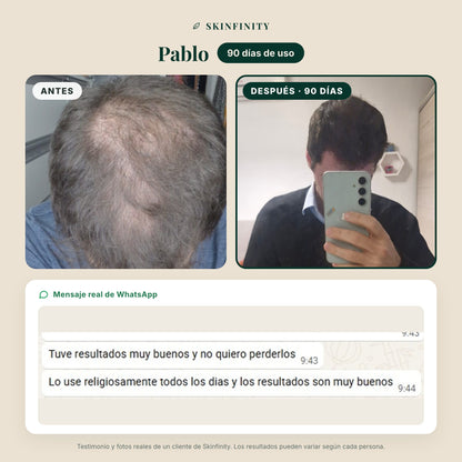 Serum Skinfinity - Fórmula avanzada de Saw Palmetto y Jojoba para crecimiento capilar